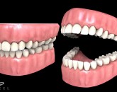 Gum and teeth model